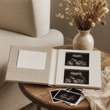 Open ultrasound photo album on a warm wood side table